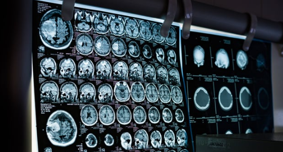Medical Evidence