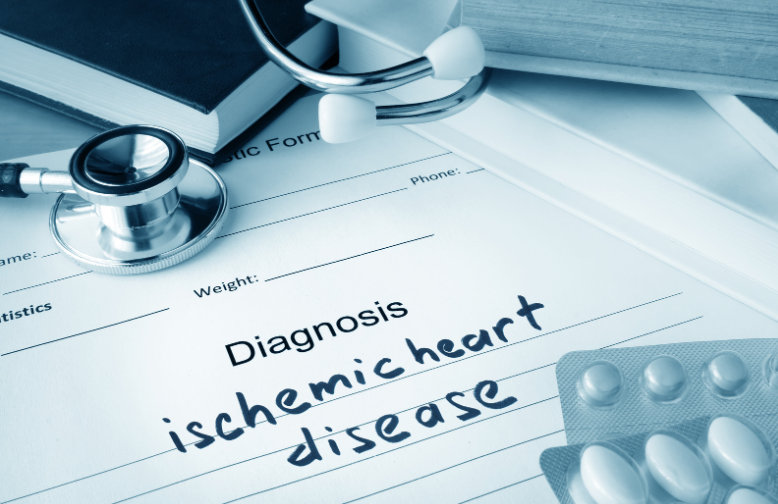 Ischemic Heart Disease